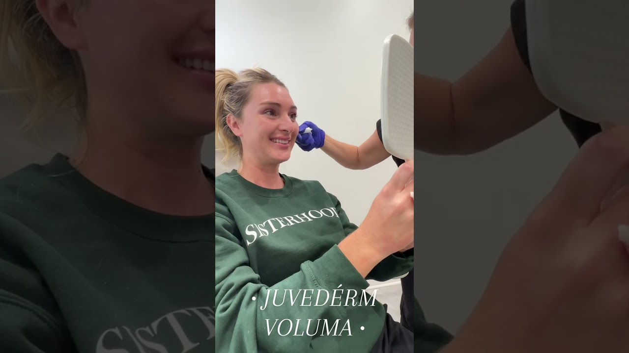 Juvéderm Voluma with Suzanne Lancaster, Nurse Practitioner | Northshore Plastic Surgery