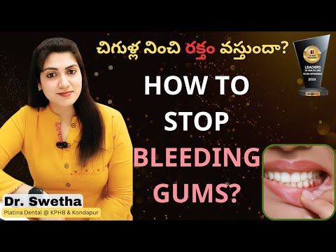 Best Treatment to Stop Bleeding Gums | Bleeding Gums Treatment | చిగుళ్ల నుంచి రక్తం |Platina Dental
