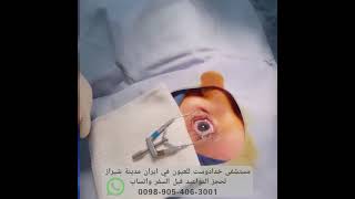 علاج الحول وإنحراف العيون في ايران مستشفى خدا دوست