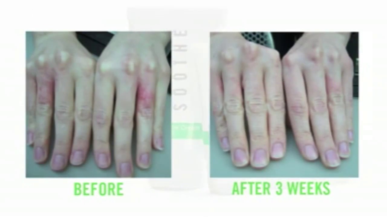 Soothe Regimen from Rodan + Fields