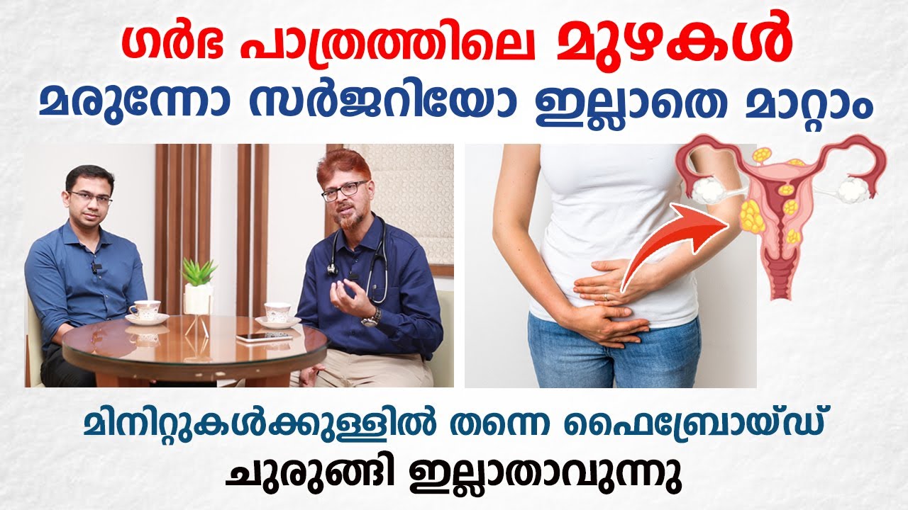 ഗർഭ പാത്രത്തിലെ മുഴകൾ മരുന്നോ സർജറിയോ ഇല്ലാതെ ഒഴിവാക്കാം | Fibroid Treatment | Arogyam
