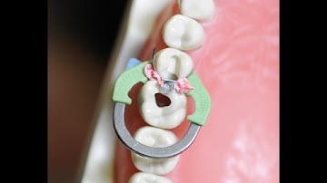 ADC Practical Exam Guidance: Sectional Matrix System