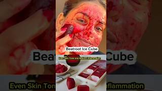 5 Ice Cubes For Summer #skincare #beauty #beautiful
