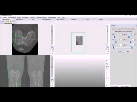Registration based Automatic Segmentation