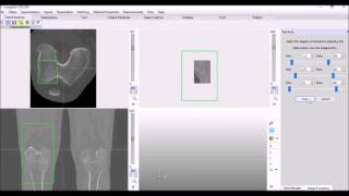 Registration based Automatic Segmentation