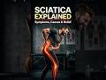Is It Sciatica? Back Pain Radiating to Leg Explained