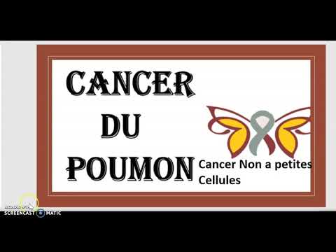 Vidéo: Cancer Du Poumon - Traitement, Symptômes, Stades