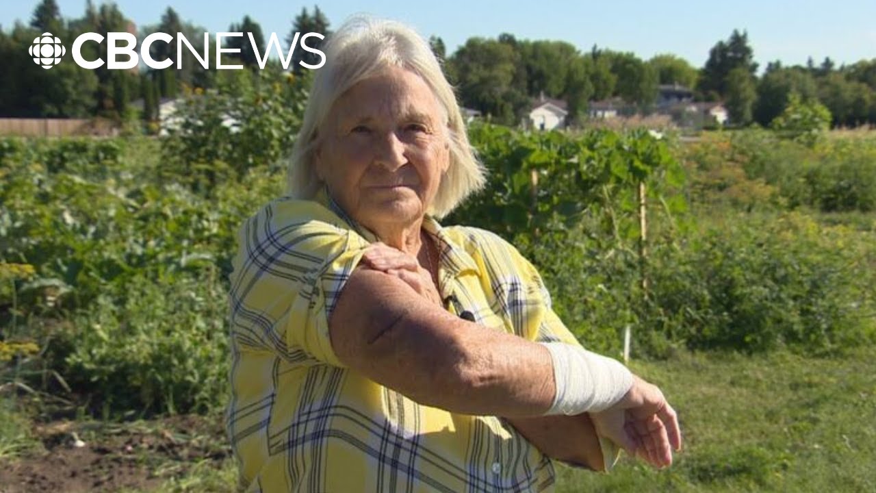 75-year-old Saskatoon woman recounts attack in community garden