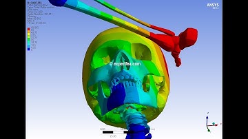 Biomechanics of the leg kick to the head with spine - ANSYS Explicit Dynamics, 1st in the World!!!