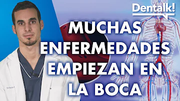 ¿Se puede tener una infección bacteriana en la boca?