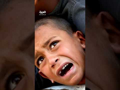 تدهور الوضع الصحي في غزة: ارتفاع الوفيات وتفشي الأمراض