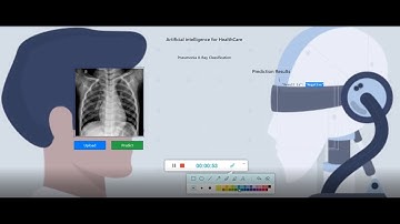 Pneumonia prediction on X-ray images using Deep learning Computer Vision #Artificial Intelligence