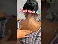dark neck Clean it and keep it in the house with propercondition😱 #cleancultureshortvideo #skincare