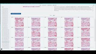 MEDICAL AI - AI for Multiplex Immunofluorescence in Histopathology