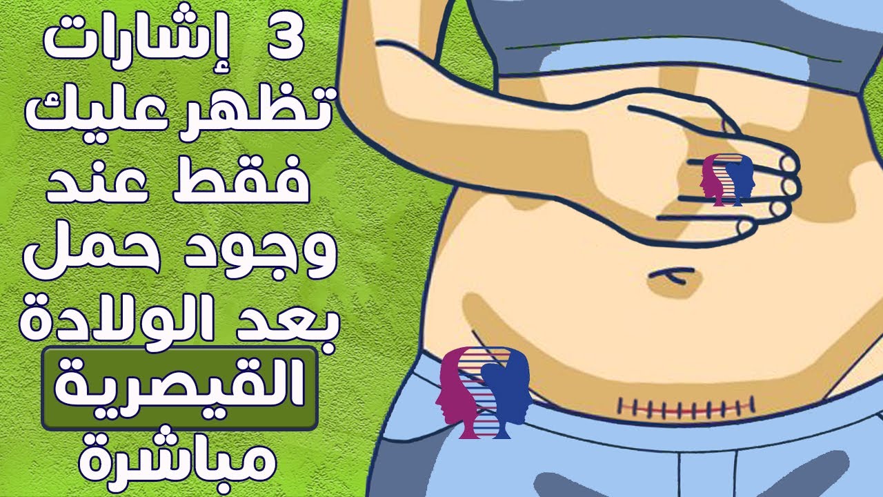 إشارات تظهر فقط عند وجود حمل بعد القيصرية مباشرة.. هل تختلف أعراض الحمل بعد العمـ.لية القيصرية؟