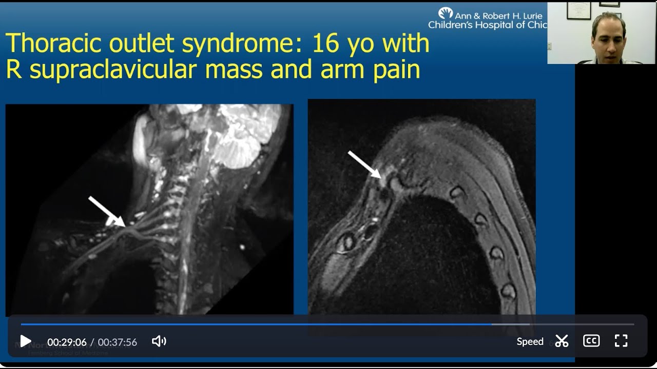 Don't be Nervous About the Nerves, by Jonathan Samet, MD