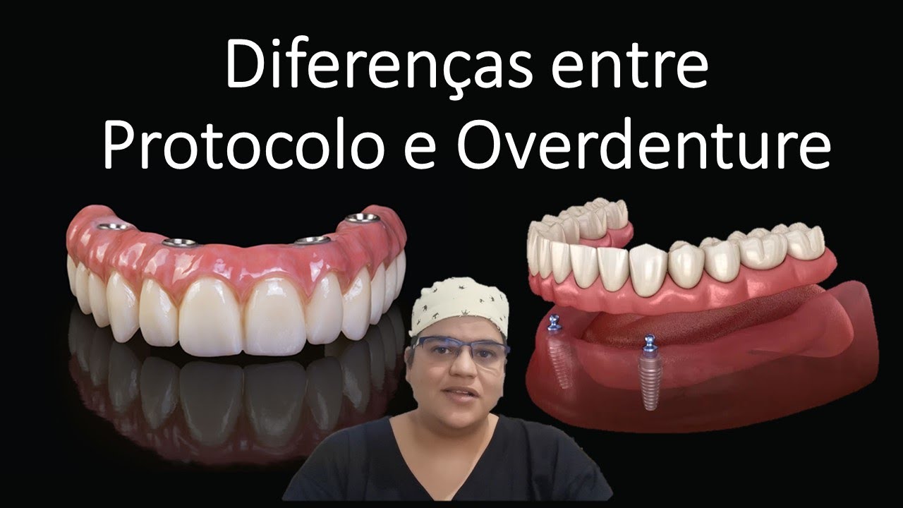 Diferenças entre dentadura fixa e removível sobre implantes | Dra Bianca Rosa | Clínica Bianca Rosa
