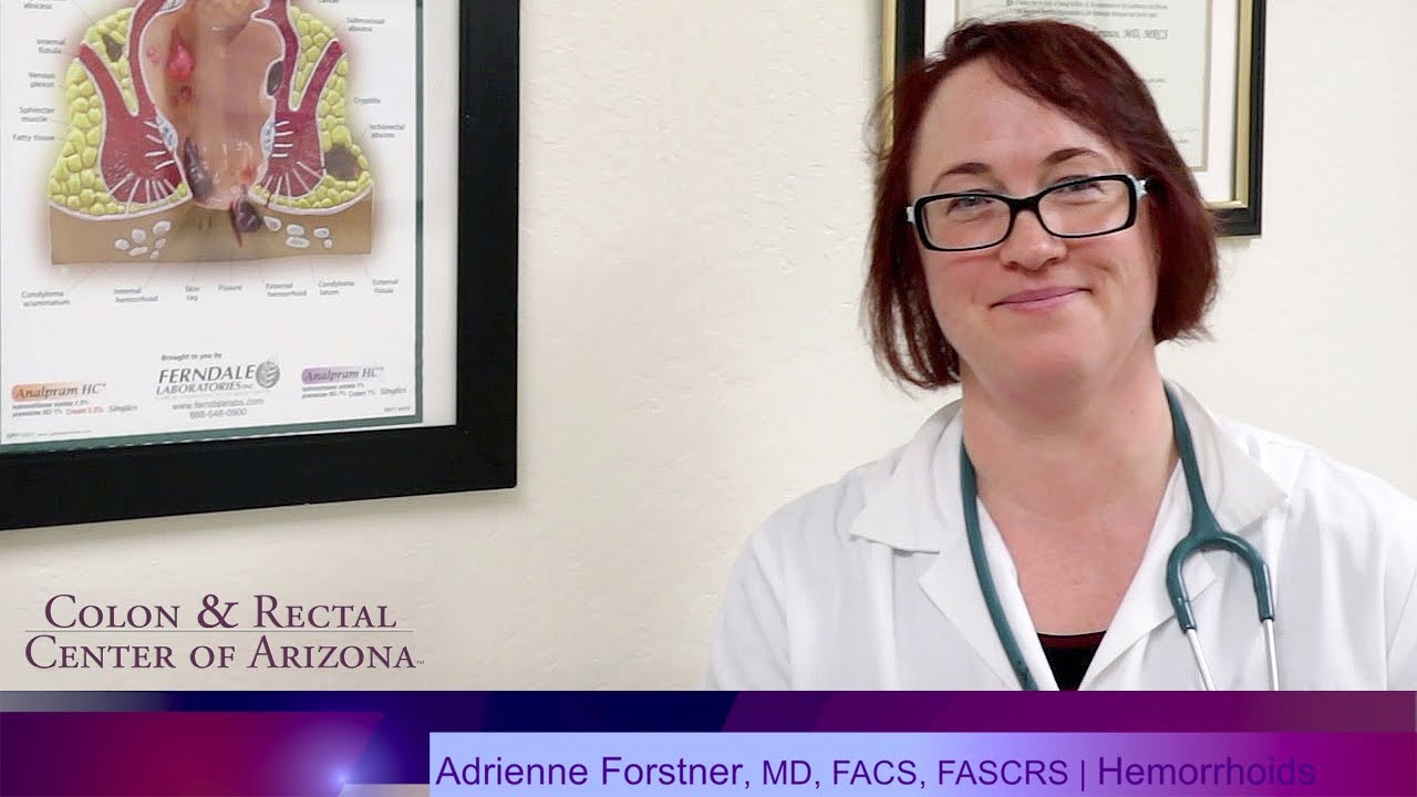 A Discussion On Hemorrhoids Adrienne ForstnerBarthell, MD, FACS