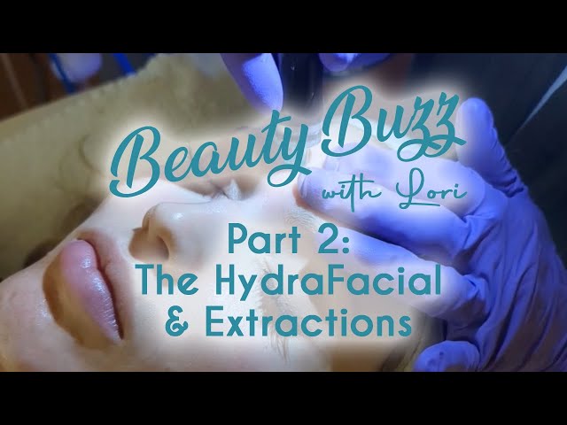 Beauty Buzz with Lori: Part 2: The HydraFacial & Extractions