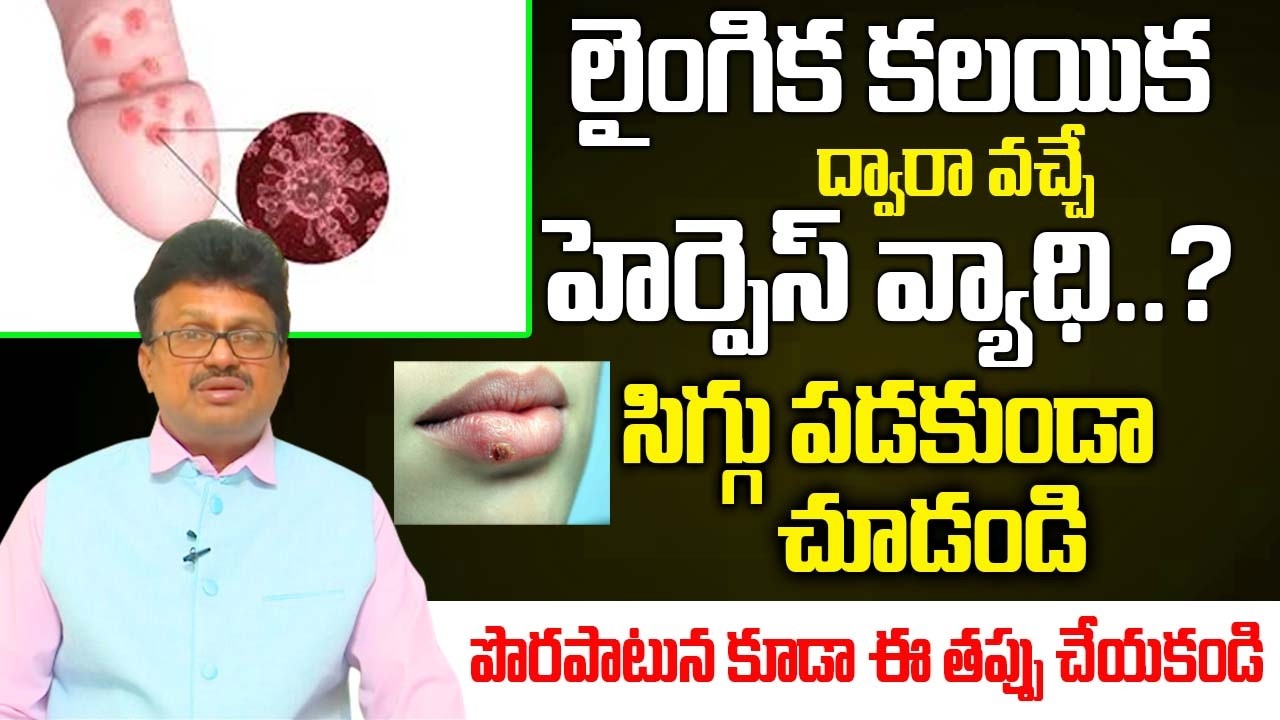 Herpes Simplex Virus | Types, Symptoms And Causes | Treatment And Prevention |‪@idsuperhealth‬