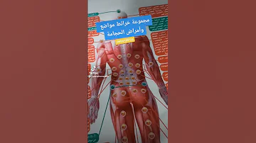 مجموعة خرائط مواضع وأمراض الحجامة 
