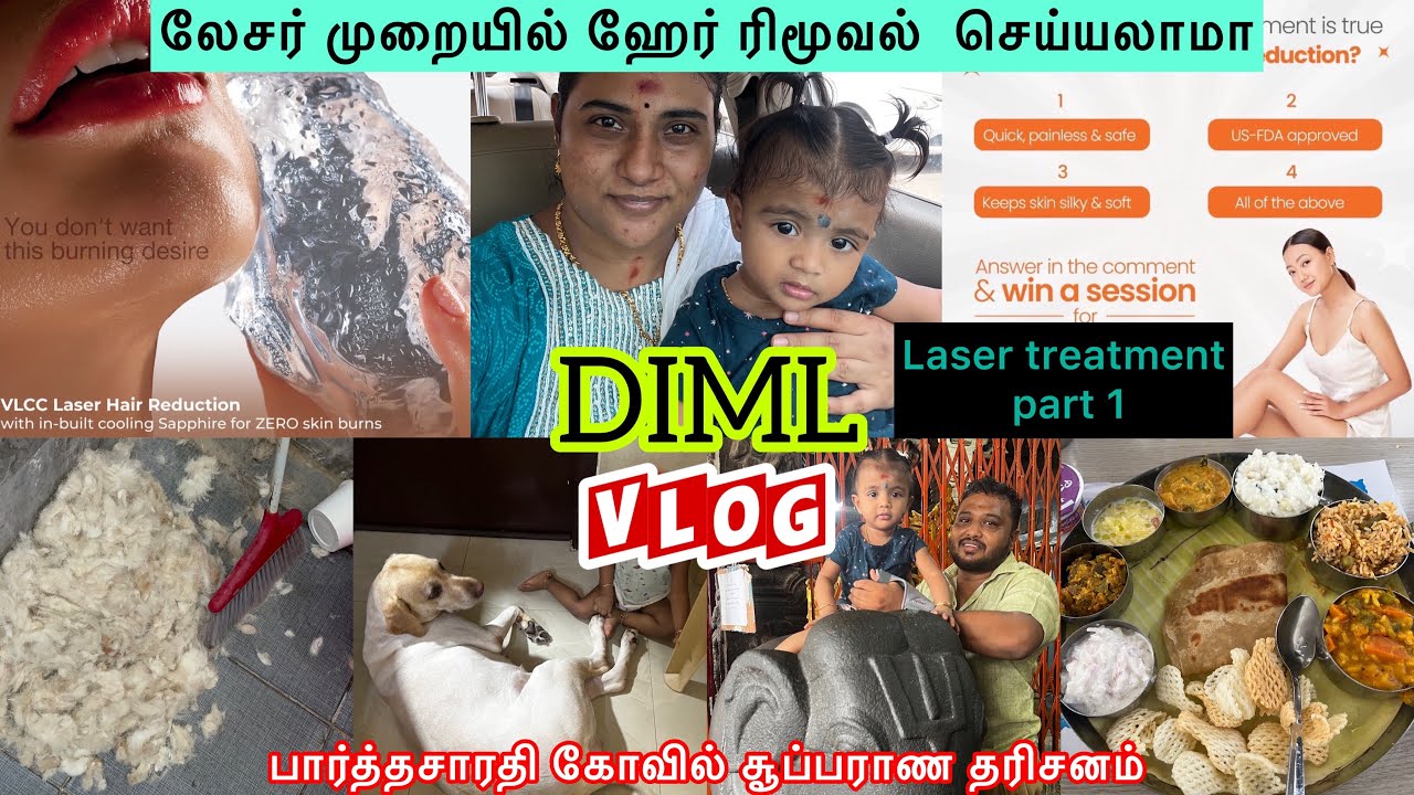 DIML VLCC Facial hair removal laser treatment experiences முகத்தில்