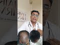 Real Hair Growth Result After 3 Months | Before vs After #Hair
