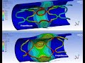 Structural simulation of a steel stent expansion - ANSYS WB Static Structural