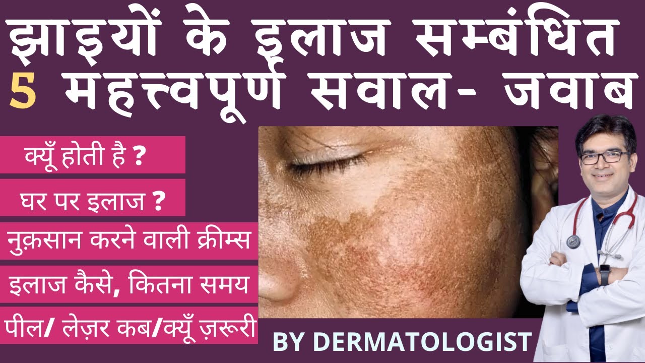 Pigmentation Treatment | झाइयों का इलाज | Dark Spots On Face Treatment | चेहरे के काले दाग़ का इलाज