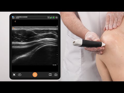 Image of Dynamic Assessment of the Posterior Shoulder and AC Joint