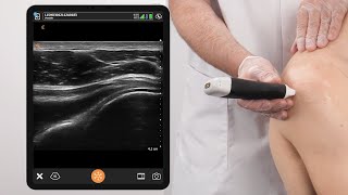 Dynamic Assessment of the Posterior Shoulder and AC Joint