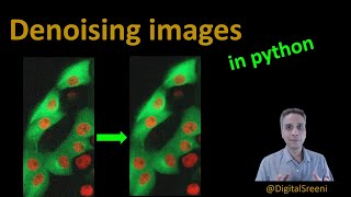 22 - Denoising microscope images in Python