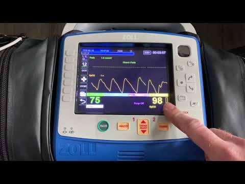 ZOLL X Series Perfusion Index-ZOLL Tips and Tricks