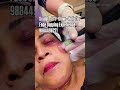 Before &amp; After Glow 😳 Face Cupping Facial #TrendingShorts #aeternum #aeternumcupping