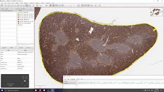 Cell Counting in QuPath