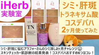 iHerb実験室#7 シミ・肝斑にトラネキサム酸を2か月間使って肌診断した結果発表！コスデバハ（Cos De BAHA）おすすめベスト6を一言ずつ紹介☆