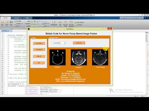 Neuro Fuzzy Based Image Fusion using Matlab Project
