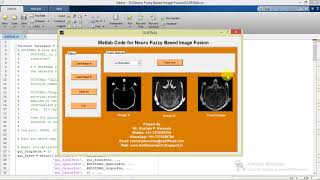 Neuro Fuzzy Based Image Fusion using Matlab Project