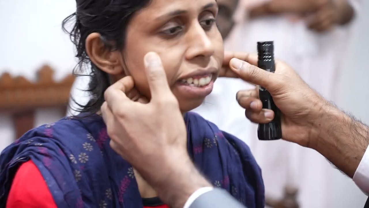 Severe Jaw Deformity - BIMAXILLARY SURGERY