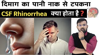 Csf Rhinorrhea Csf In Nose Medicine Treatment Csf Cerebrospinal Fluid Pharmacy Doctor
