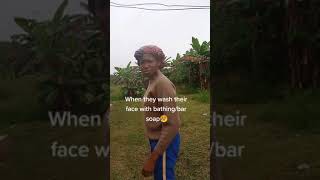 When They Wash Their Face With Bathing/Bar Soap | Using Bar Soap On Face | Bar Soap vs Face Wash