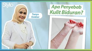 Penyebab Biduran Gatal-gatal di Kulit | Urticaria, Penjelasan Dokter Kulit (Part1) | Stylo.ID