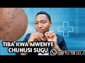 Tiba Kwa CHUNUSI SUGU USONI SIKU 7 TU Tiba Kwa CHUNUSI SUGU USONI SIKU 7 TU