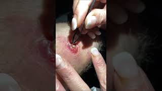 Staph infection removal from knee 🦠 #medical #health #hospital #treanding #travel #morning #best