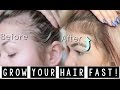 HOW I GREW MY HAIR BACK! (YOU NEED THIS!) WITH MONAT