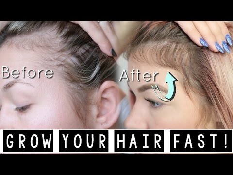 HOW I GREW MY HAIR BACK! (YOU NEED THIS!) WITH MONAT - YouTube