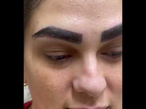 بدون افکت بدون کبودی همون لحظه بعد کاشت ابرو پیج اینستا   