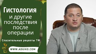 Гистология и другие последствия после операции  Рекомендации Дуйко А А