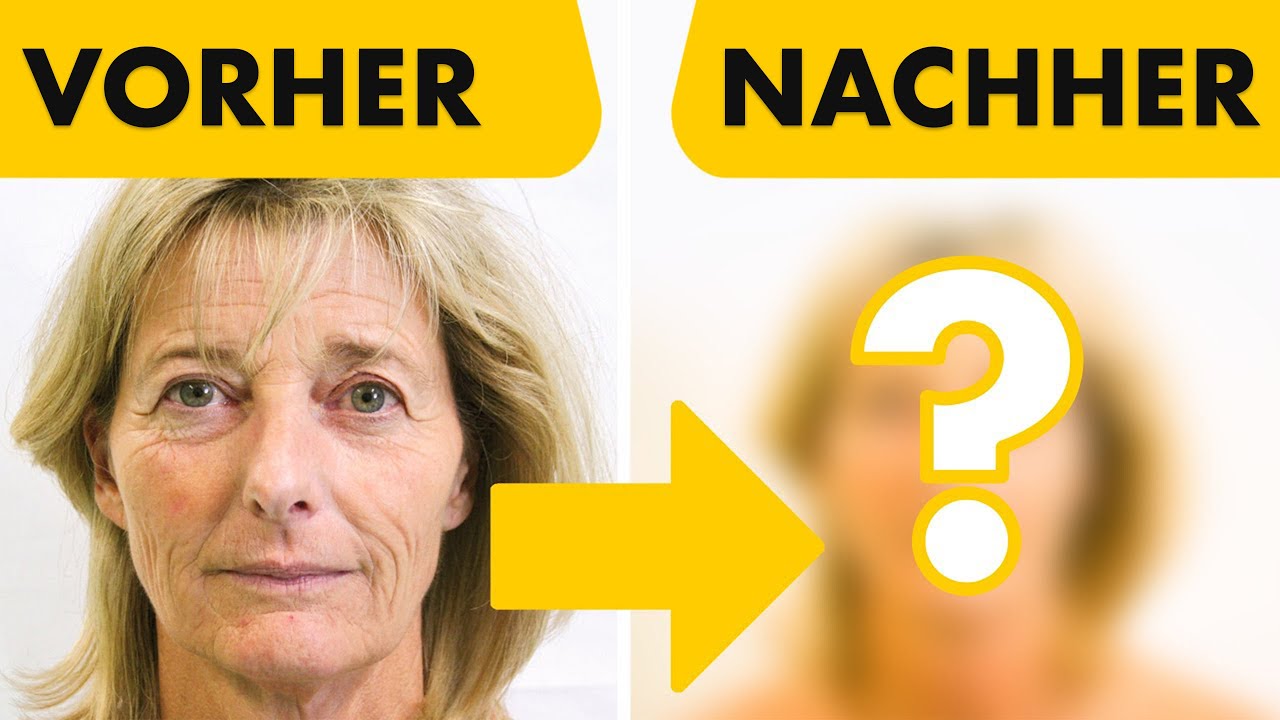 Mein bestes Facelift aus 3000 OP's! 5 Eingriffe in nur einer OP | Facelift, Halslift, Augenlider...