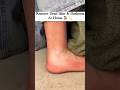 Clean Feet Dirt & Tanning Easily | Fair Feet Tips & Trick #tanning #feetdirtcleaning #ytshorts